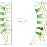 腰を支える腰椎の前彎